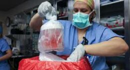 Pioneer in Xenotransplantation: First Recipient of Pig Kidney Transplant Passes Away